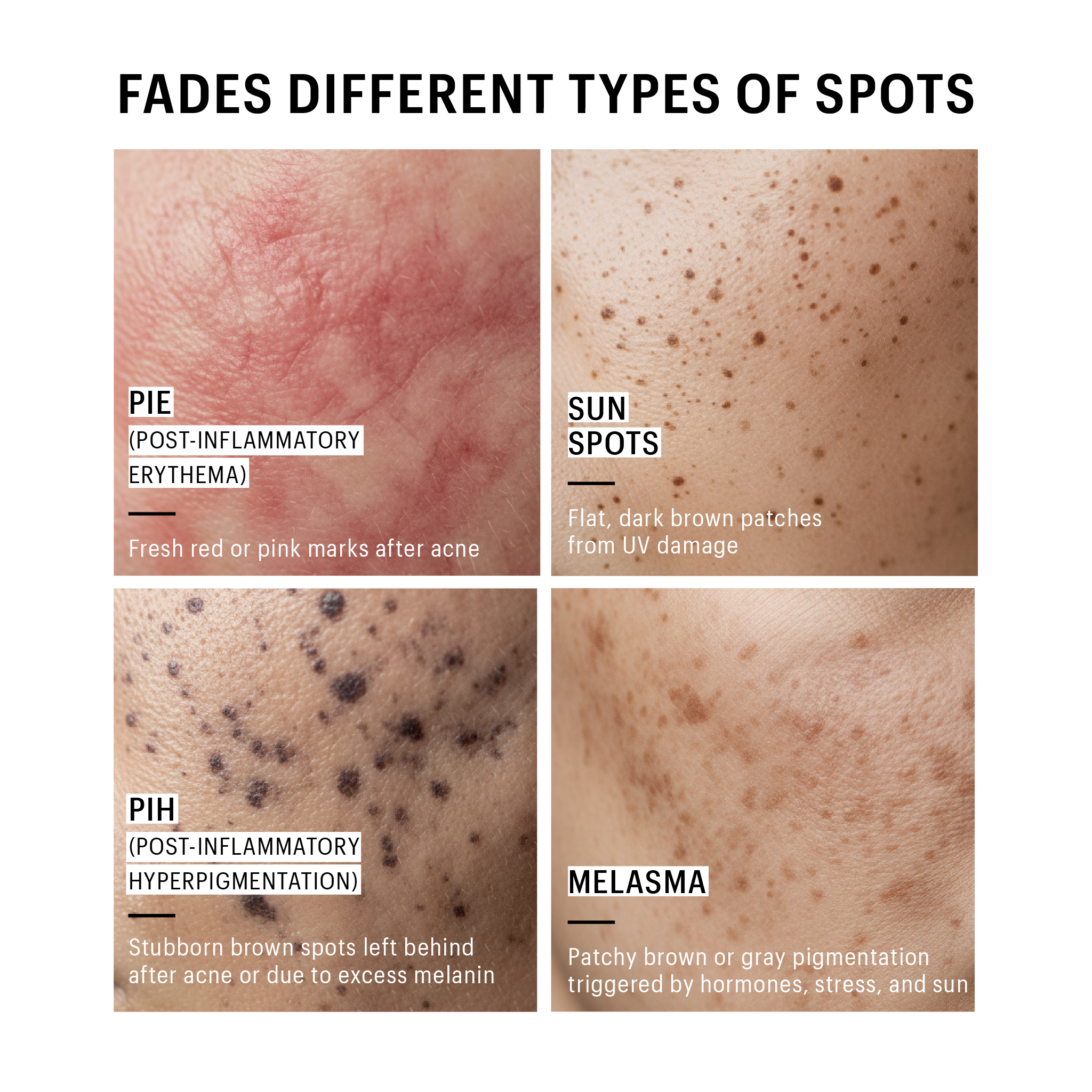 Hyperfade | Multi pathway brightening serum | 30ML